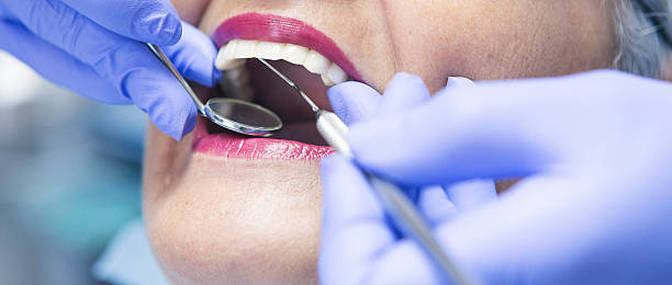 Best Cracked Tooth Emergency Dentist  in Carter Lake, IA